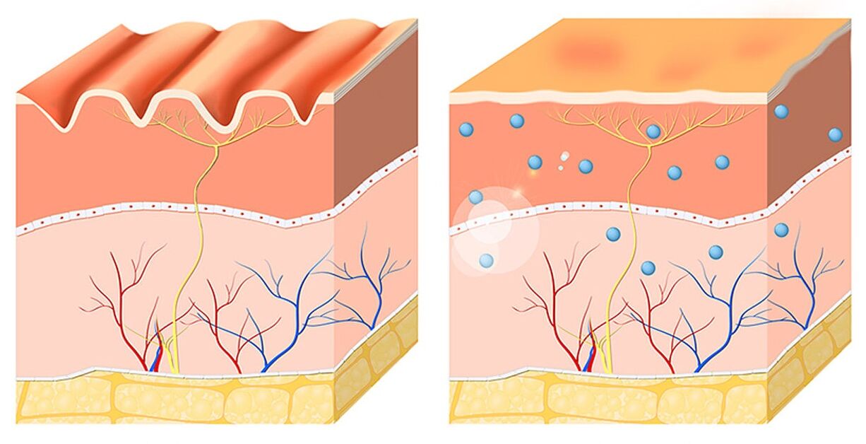 Inno Gialuron unifica e hidrata la epidermis