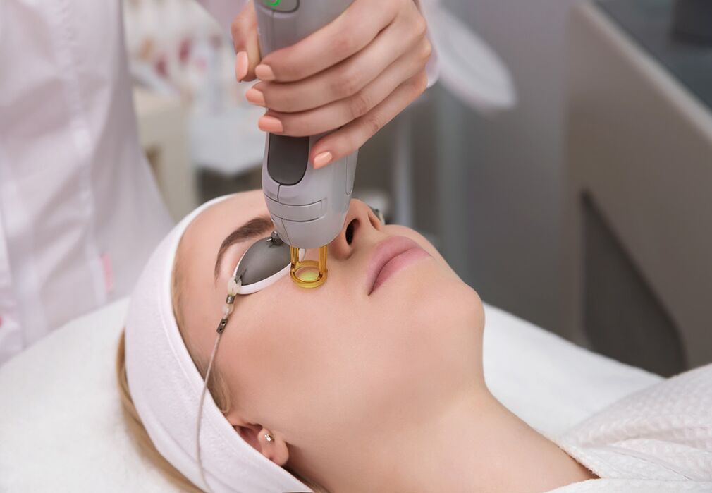Cómo se realiza el rejuvenecimiento con láser de la piel del contorno de ojos.